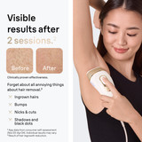 Braun Silk·expert Pro 5 IPL: Alternative to Laser Hair Removal with 4 Caps and Vanity Case, PL5347